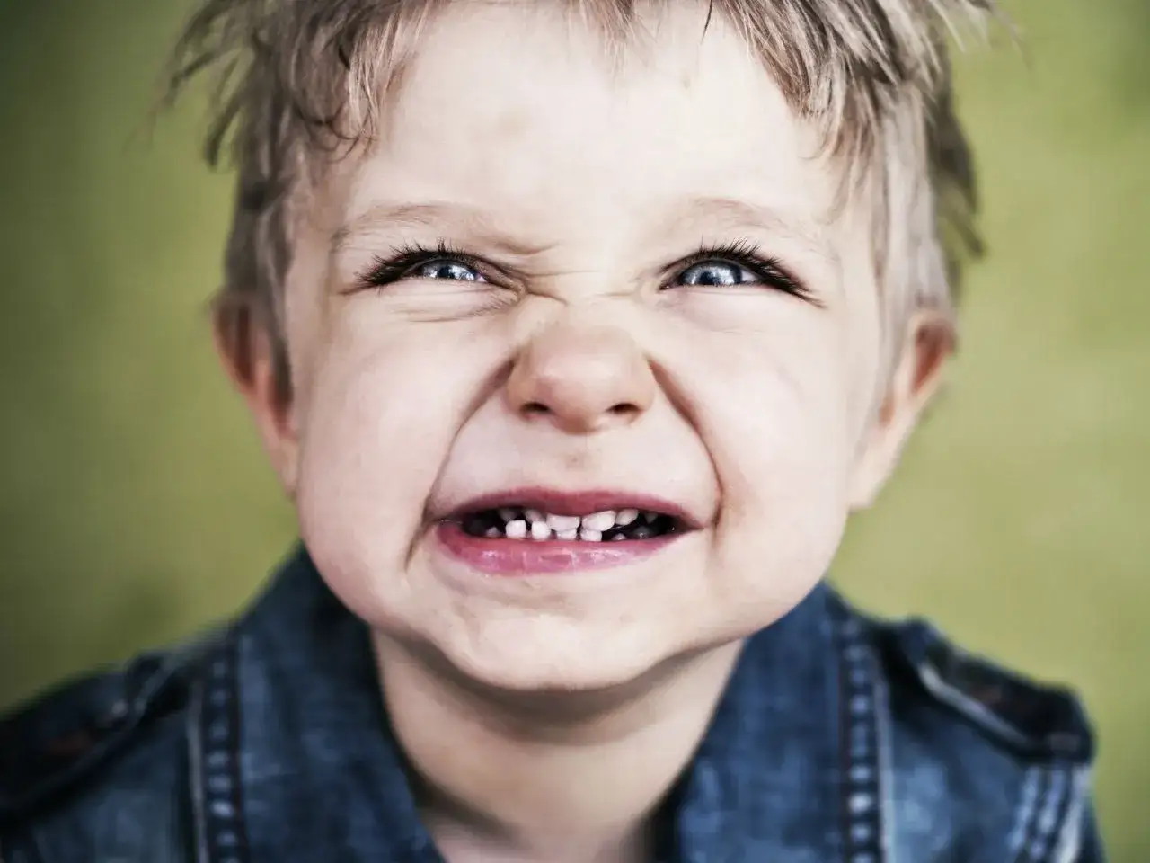 Primo piano di un bambino con espressione accigliata, che potrebbe suggerire bruxismo nei bambini.