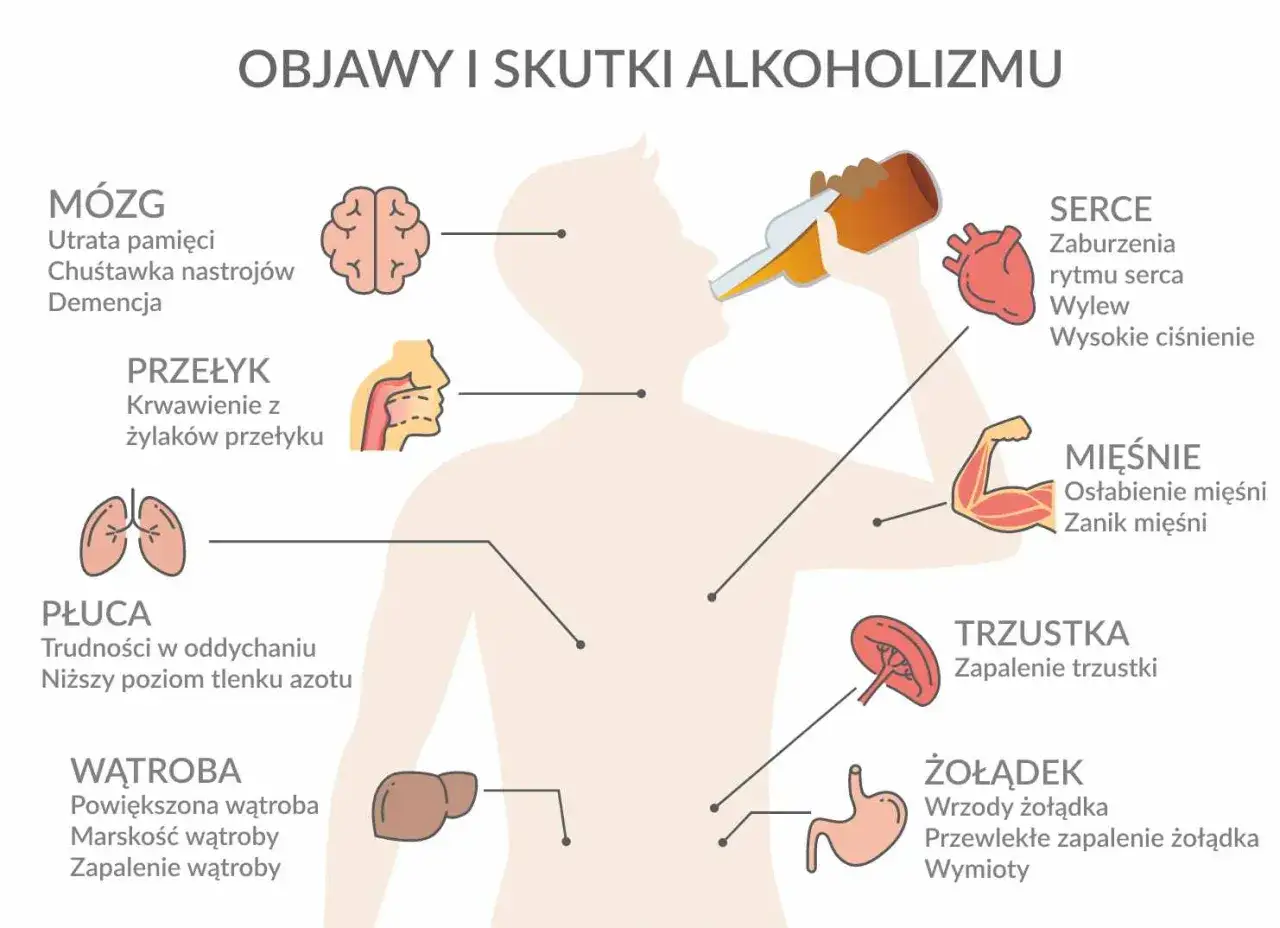 Ilustracja pokazuje skutki picia alkoholu dla organizmu. Alkoholik cierpi na problemy z mózgiem, sercem, płucami, wątrobą, żołądkiem, trzustką i mięśniami.