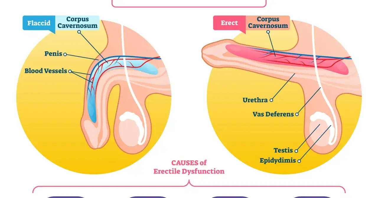 Illustrazione anatomica del pene in stato flaccido ed eretto, che mostra le cause della disfunzione erettile, ovvero se lui perde l'erezione durante il rapporto.