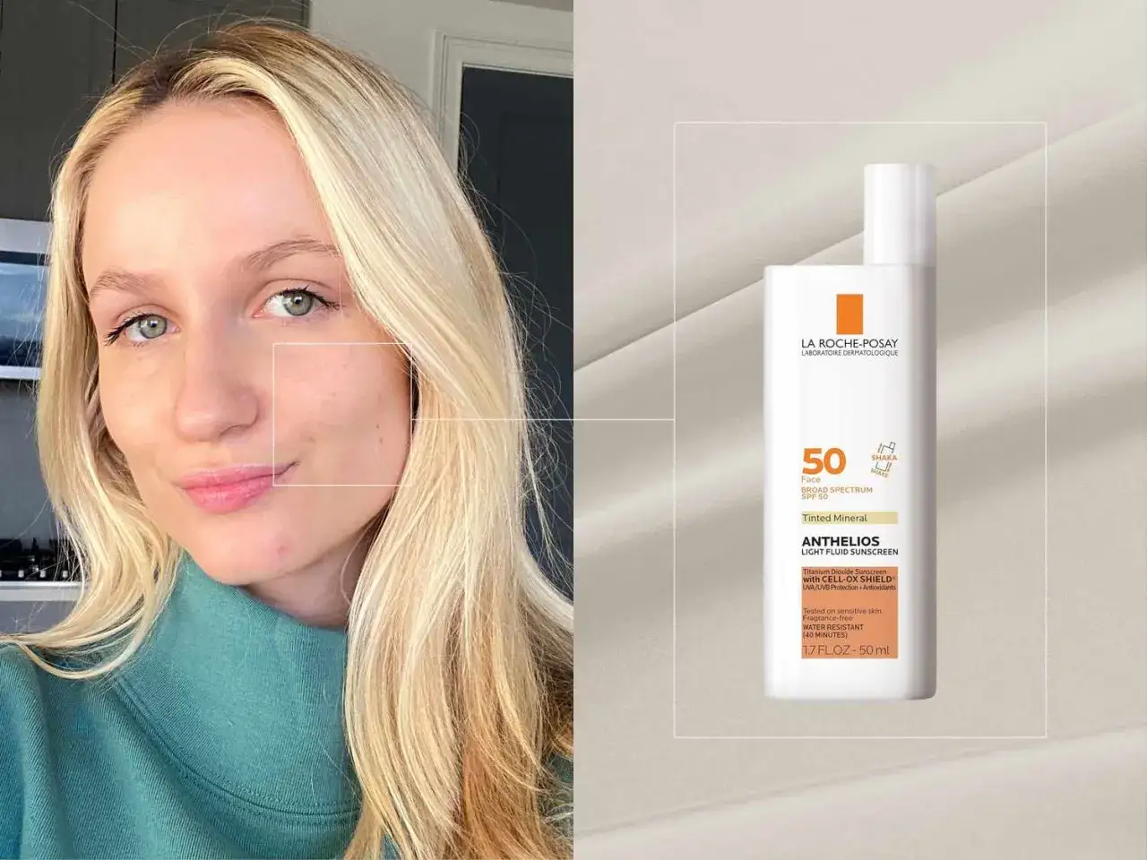 Kvinna med rosacea som anv&auml;nder solskydd. Niacinamid kan hj&auml;lpa till att lugna huden.