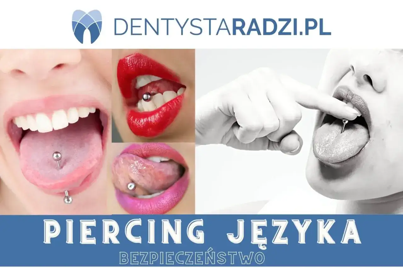 Kolczyk w ustach, na języku, prezentowany w różnych zbliżeniach. W tle logo DENTYSTARADZI.PL i napis