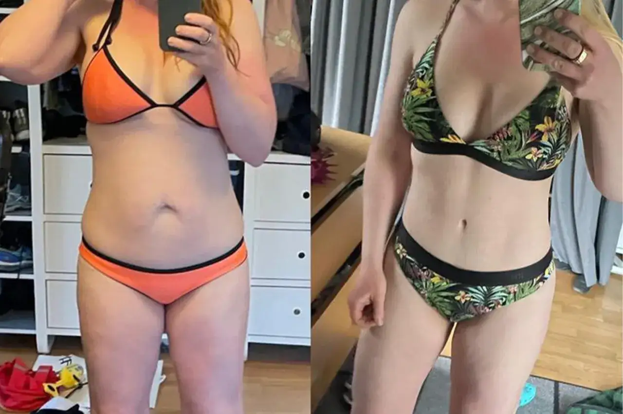 Före- och efterbilder visar en kroppsförvandling. Till vänster, en person i orange bikini med mjukare former. Till höger, samma person i mönstrad bikini med en plattare mage, som efter en liten bukplastik.