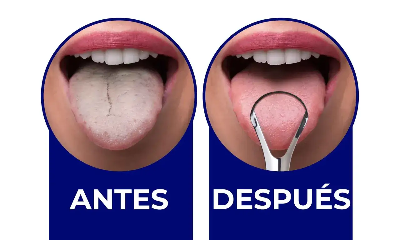 Antes: lengua blanca y sucia, con posible olor a caca en la boca. Después: lengua rosada y limpia tras usar un limpiador lingual.