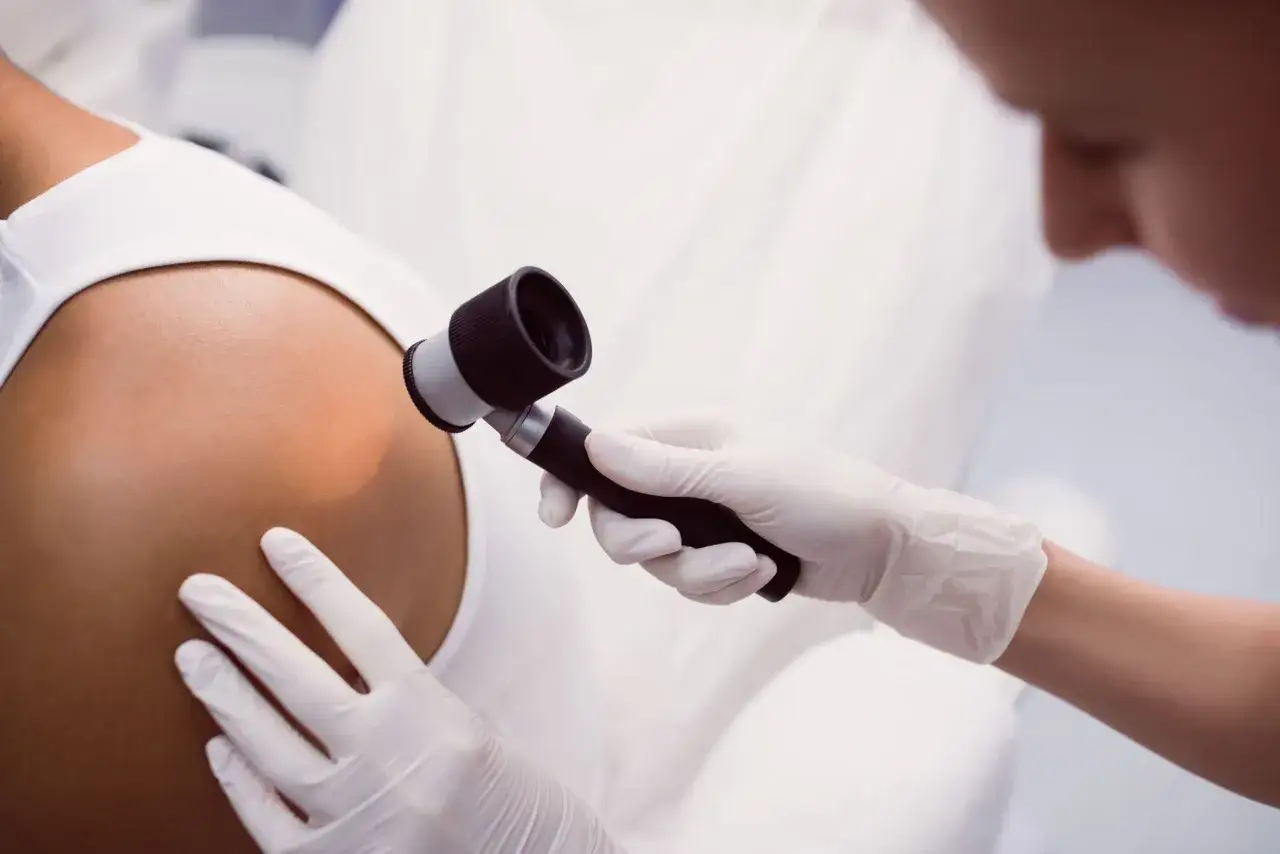 Dermatolog w białej rękawiczce bada skórę pacjenta dermatoskopem.