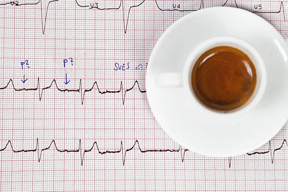 EKG z zaznaczonymi zaburzeniami rytmu i filiżanka kawy. Czy przy migotaniu przedsionków można pić kawę? To pytanie nurtuje wielu.