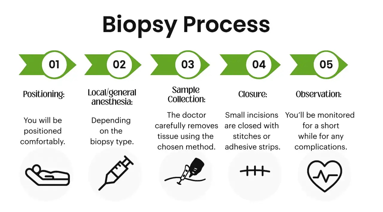 Proces biopsji: pozycjonowanie, znieczulenie, pobranie próbki, zamknięcie rany, obserwacja. Czy biopsja jest bezpieczna? Tak, dzięki tym etapom.