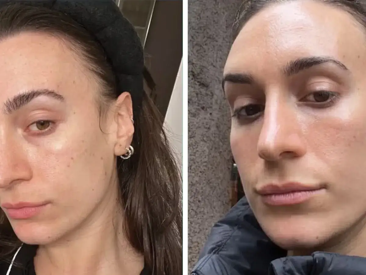 Kobieta pokazuje swoją skórę przed i po zastosowaniu retinolu. Widać poprawę tekstury i kolorytu.