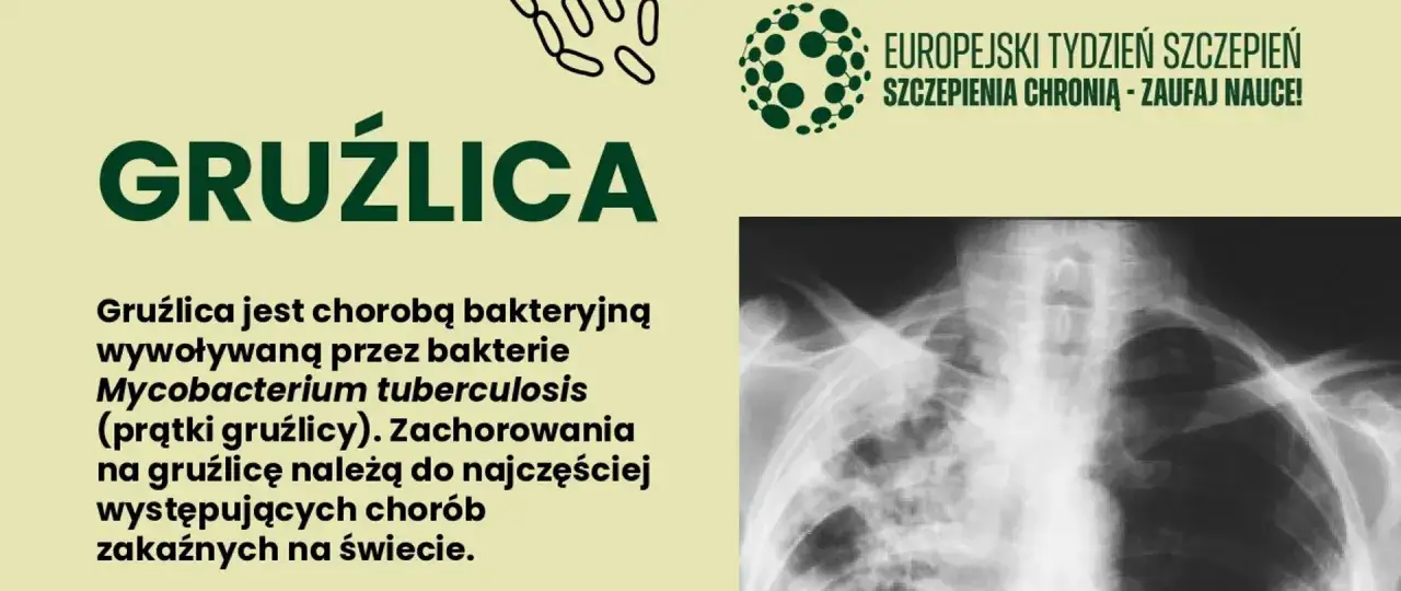 Grafika informuje o gruźlicy, chorobie bakteryjnej. Widoczny rentgen klatki piersiowej pokazuje skutki tej choroby.