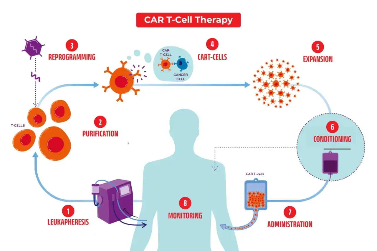 Schemat terapii CAR T-cell: pobranie, oczyszczanie, przeprogramowanie, ekspansja, kondycjonowanie, podanie i monitorowanie.