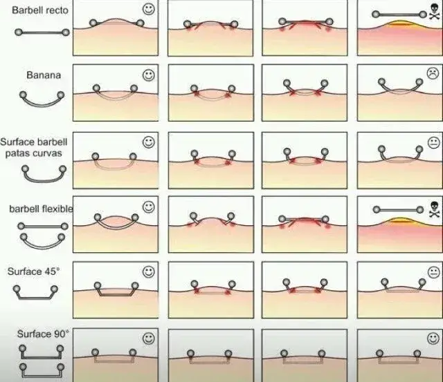Migracja kolczyka surface piercing