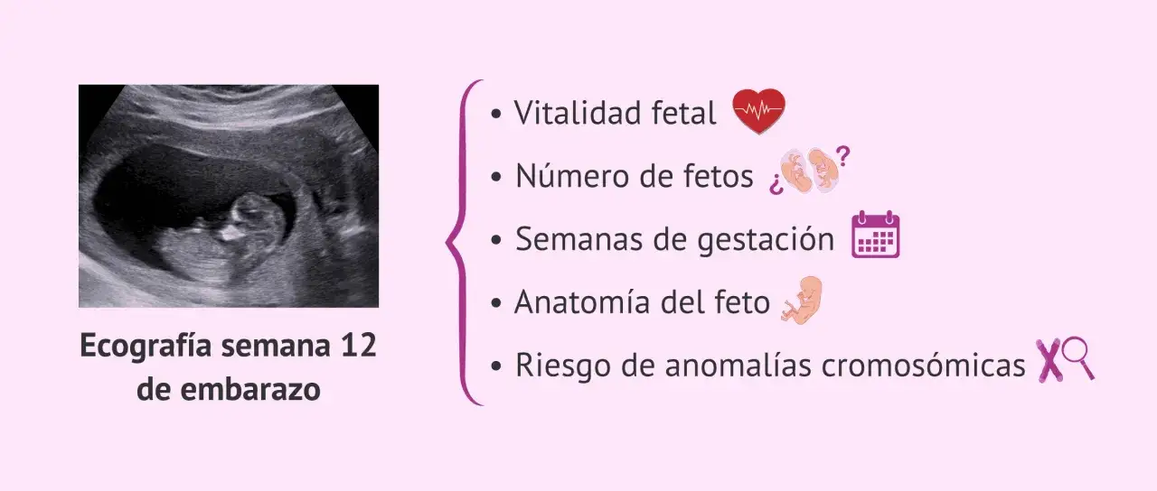 Ecograf&iacute;a de semana 12 de embarazo, revisando vitalidad, n&uacute;mero, semanas, anatom&iacute;a fetal y riesgo de anomal&iacute;as.