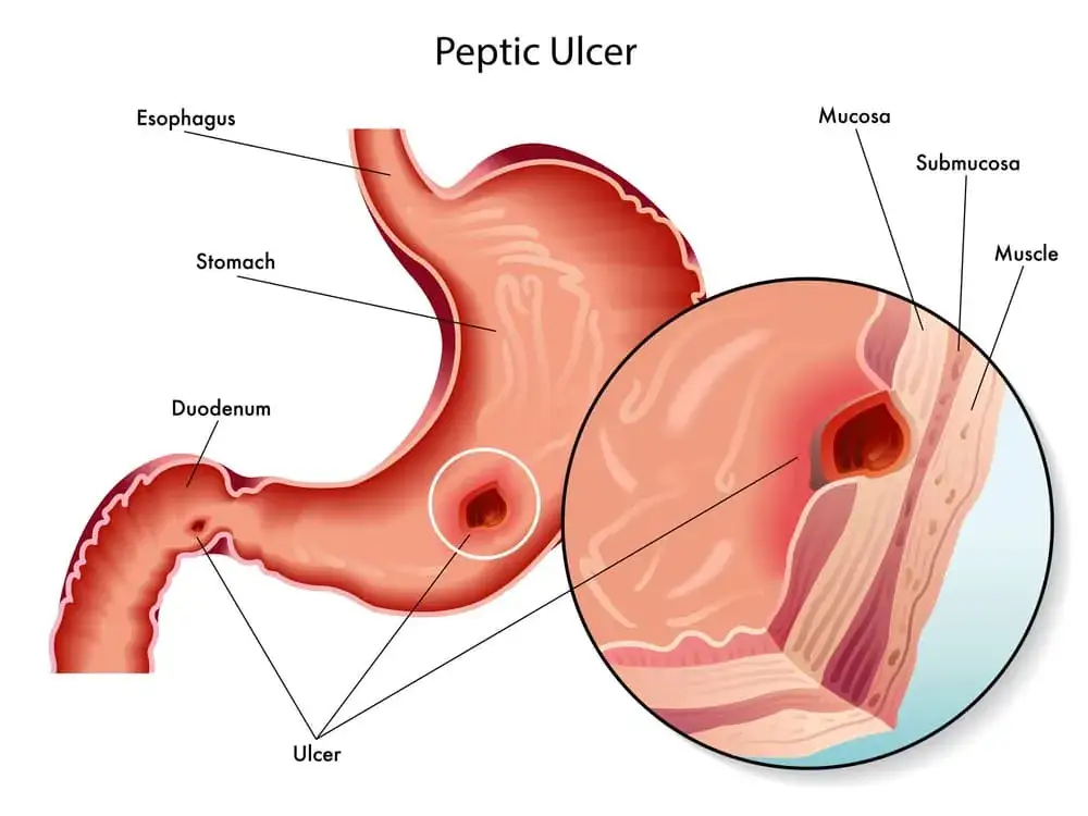 anatomia dwunastnicy i żołądka