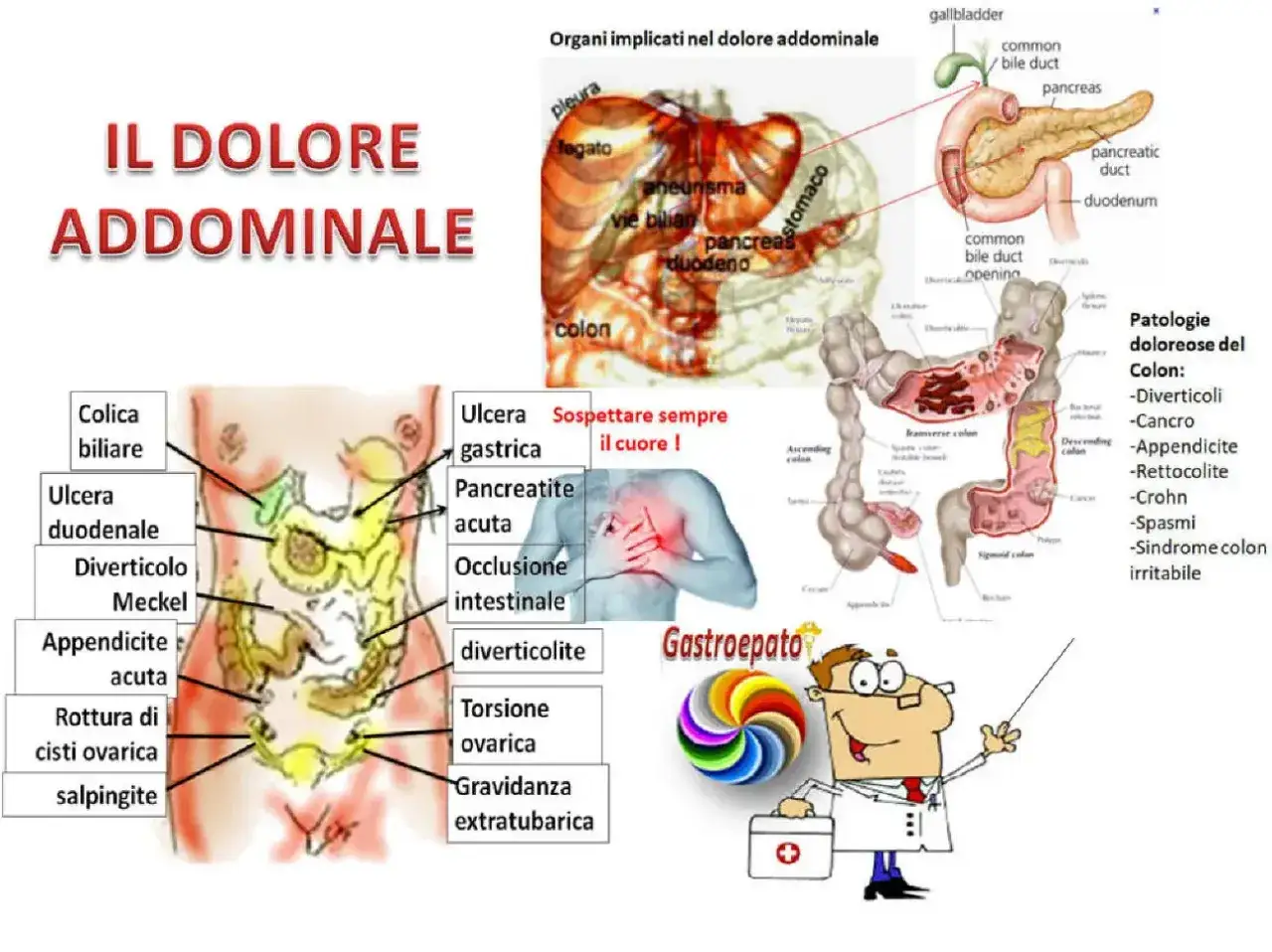 Illustrazione anatomica del corpo umano con organi e cause di **coliche addominali**. Elenca patologie del colon e organi implicati nel dolore.
