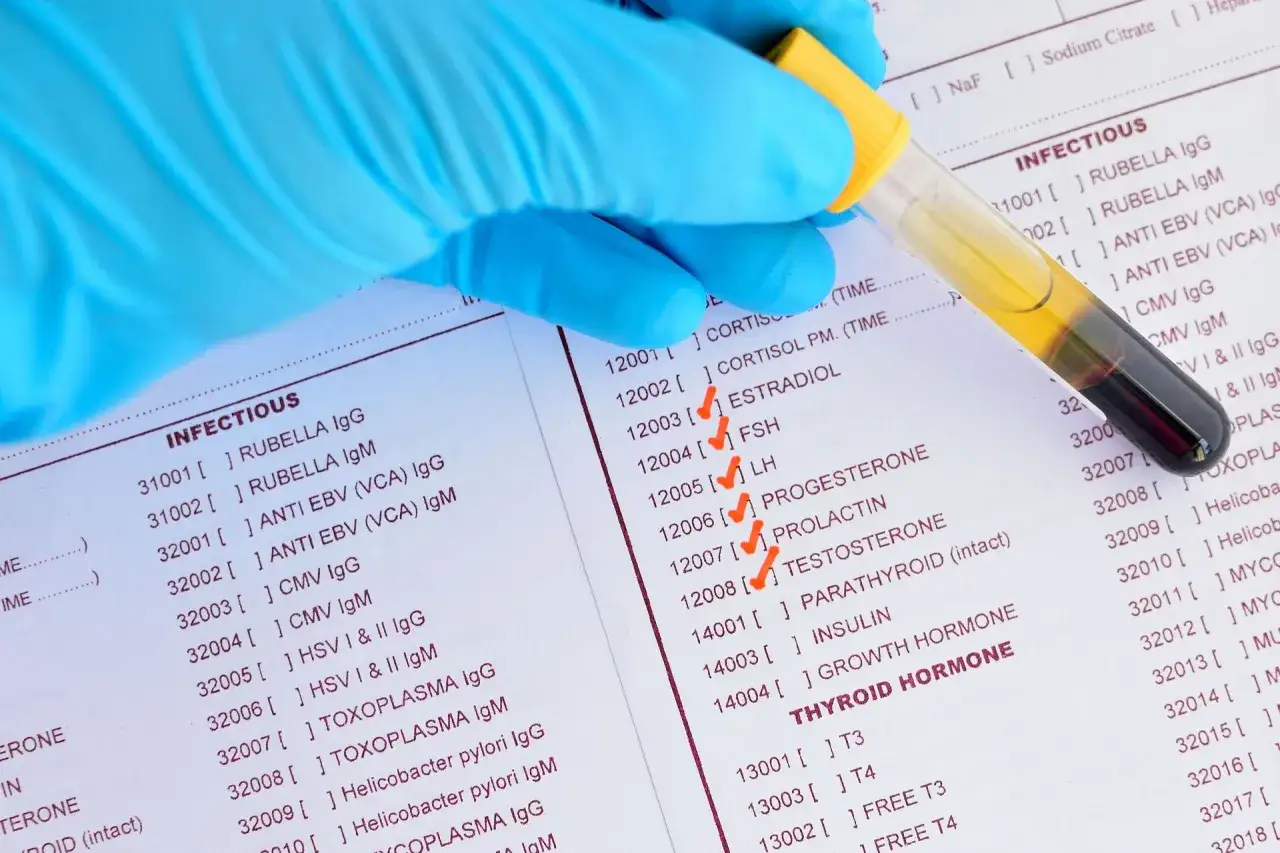 Zdjęcie Hiperprolaktynemia: objawy, diagnostyka i jak obniżyć prolaktynę?