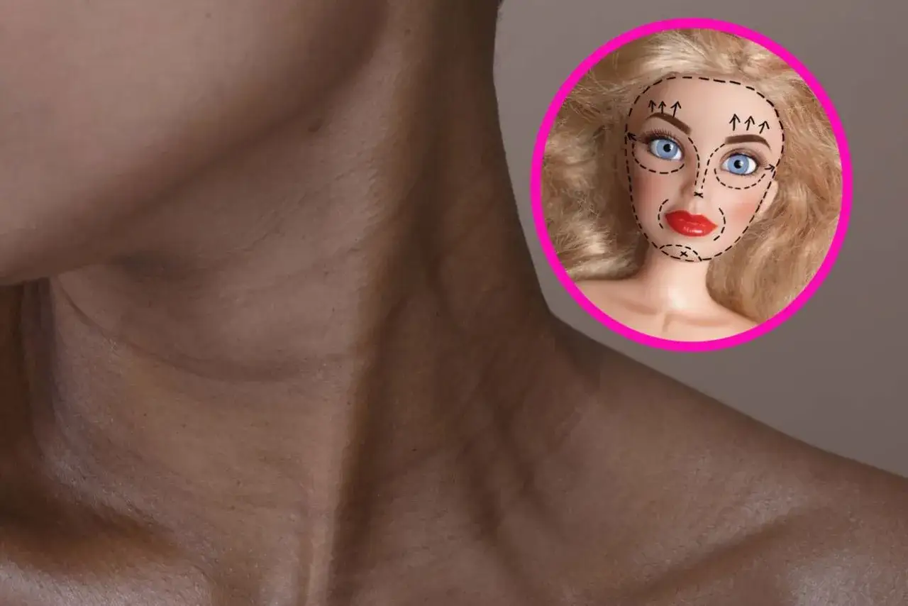 Barbie Botox przed i po