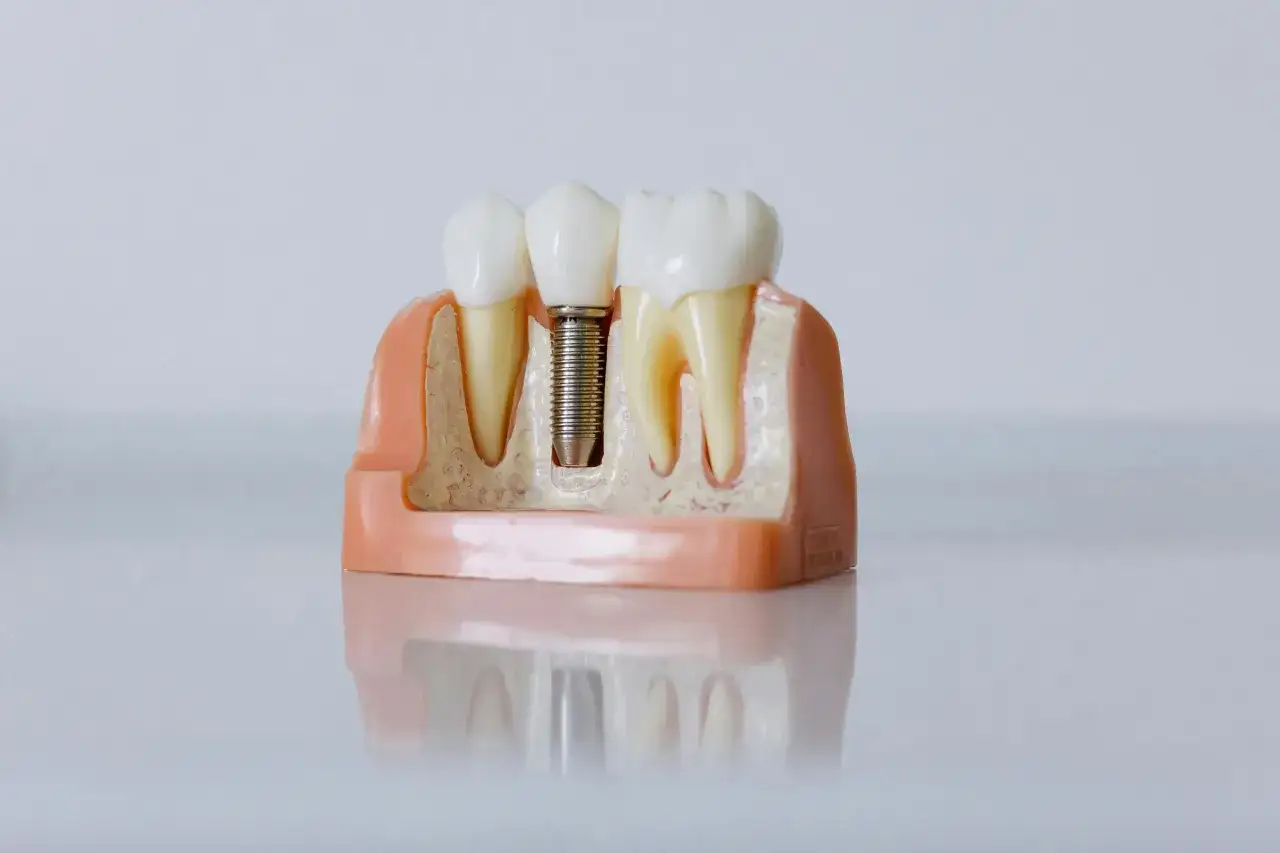 Diagram przeciwwskazań do implant&oacute;w zęb&oacute;w