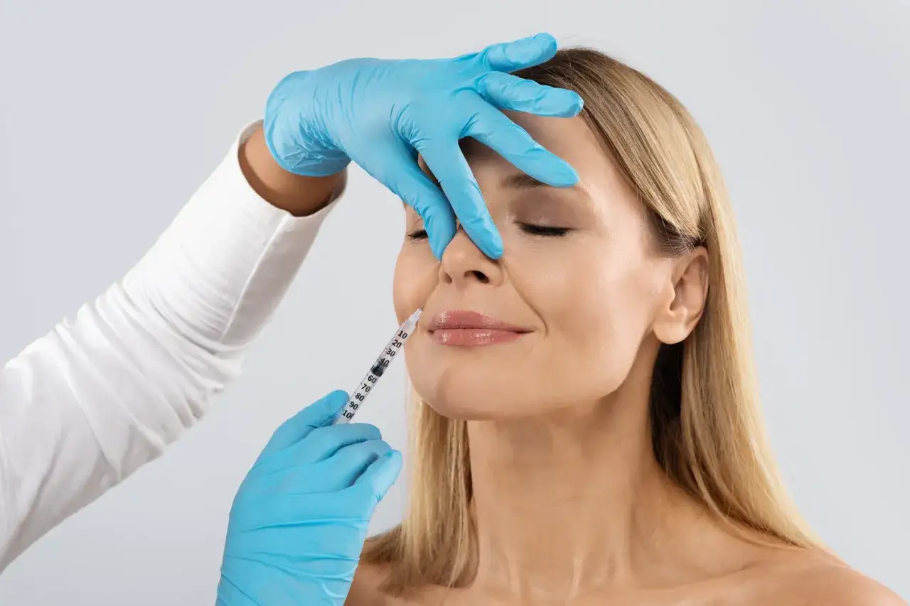 Ästhetische Behandlung: Eine Frau erhält eine Unterspritzung gegen Nasolabialfalten mit 30.
