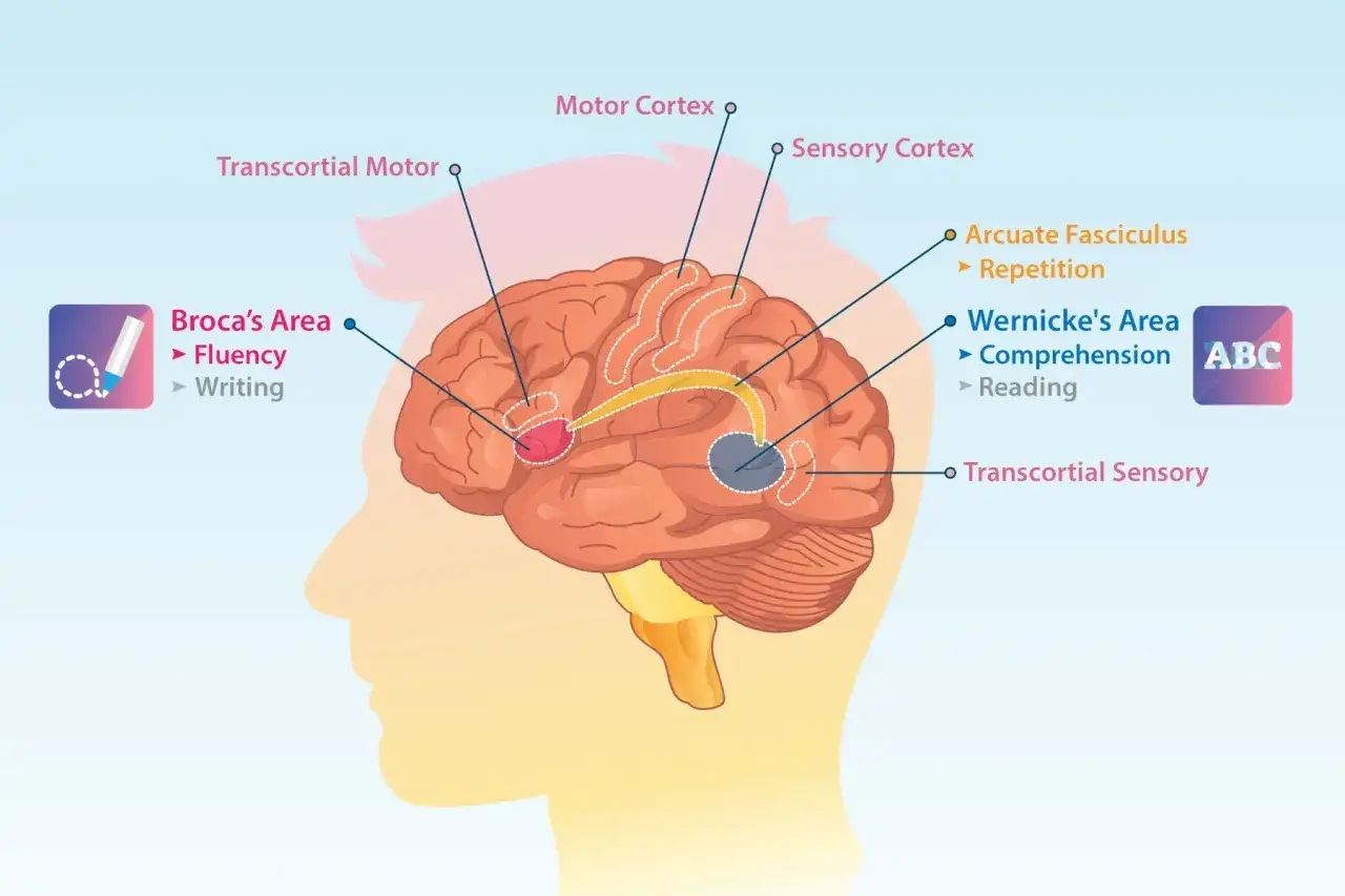 Schema del cervello che illustra le aree legate al linguaggio. L'area di Broca, associata alla fluidit&agrave; e alla scrittura, &egrave; evidenziata in rosso. Un danno qui pu&ograve; causare incapacit&agrave; di parlare.