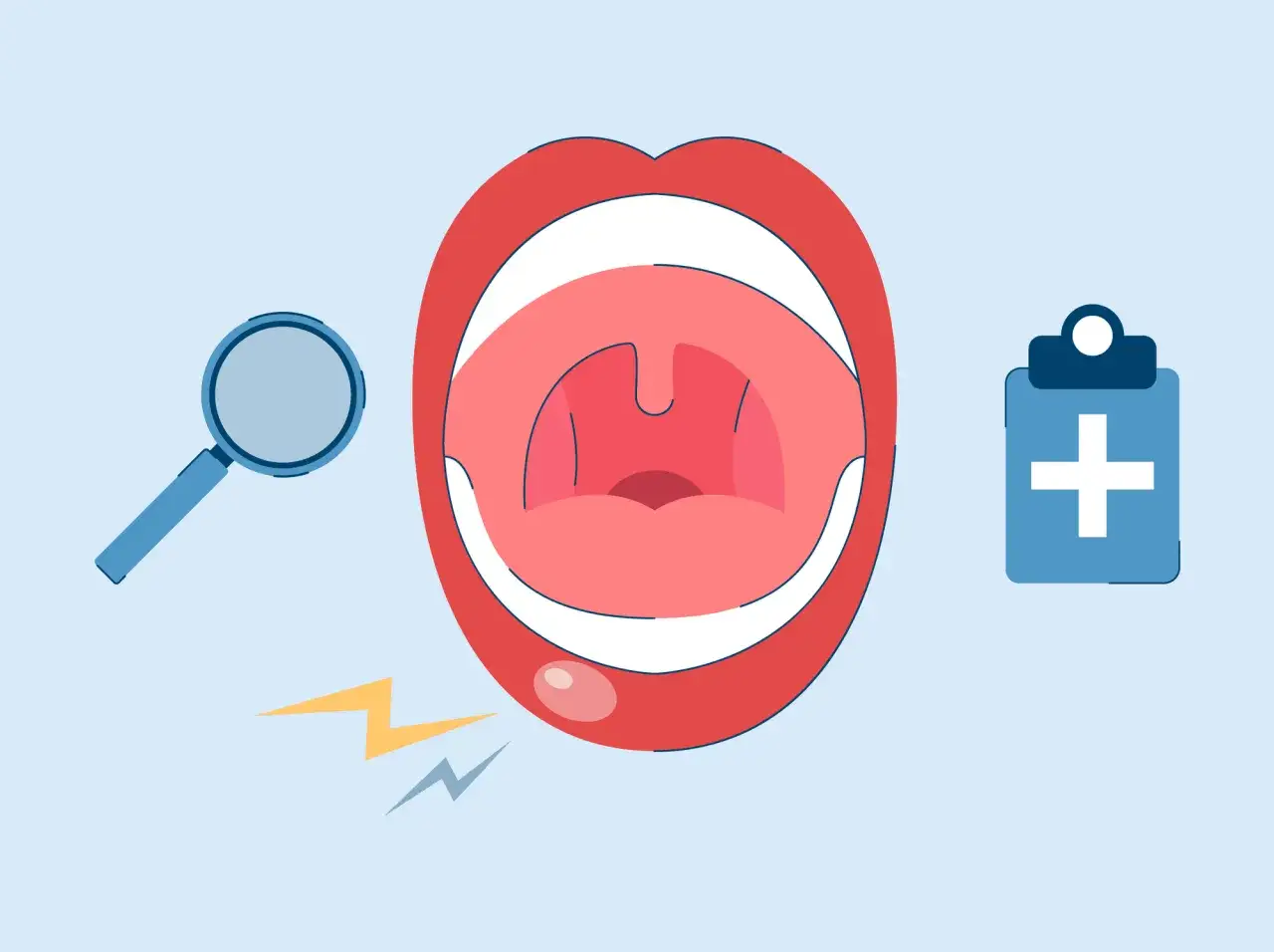 Boca abierta con lupa y símbolo médico. Ilustra el diagnóstico y **mucocele tratamiento**.