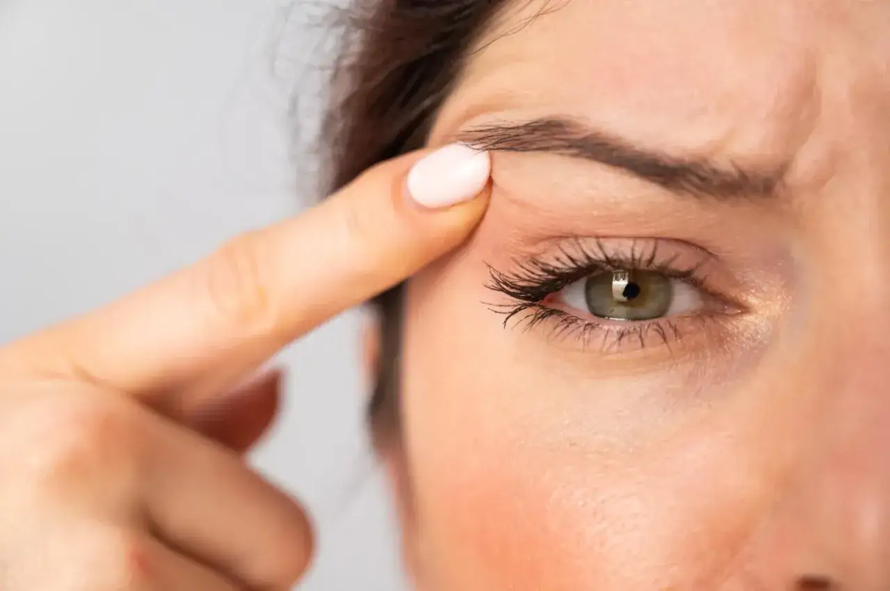En kvinna drar i huden vid ögat, som har hooded eyes.