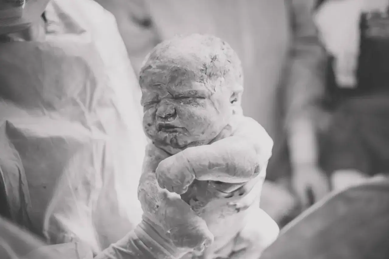 Recién nacido cubierto de vernix, un recubrimiento protector natural. Su piel parece una obra de arte.