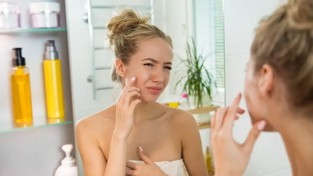 Ragazza con viso arrossato e irritato, si tocca la guancia con espressione preoccupata.