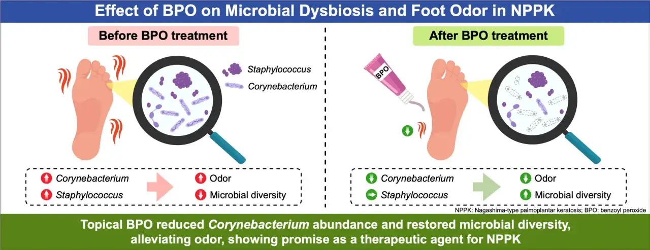 Antes del tratamiento BPO, un pie emite un olor desagradable debido a bacterias. Después, el tratamiento BPO reduce las bacterias y el olor de pies.