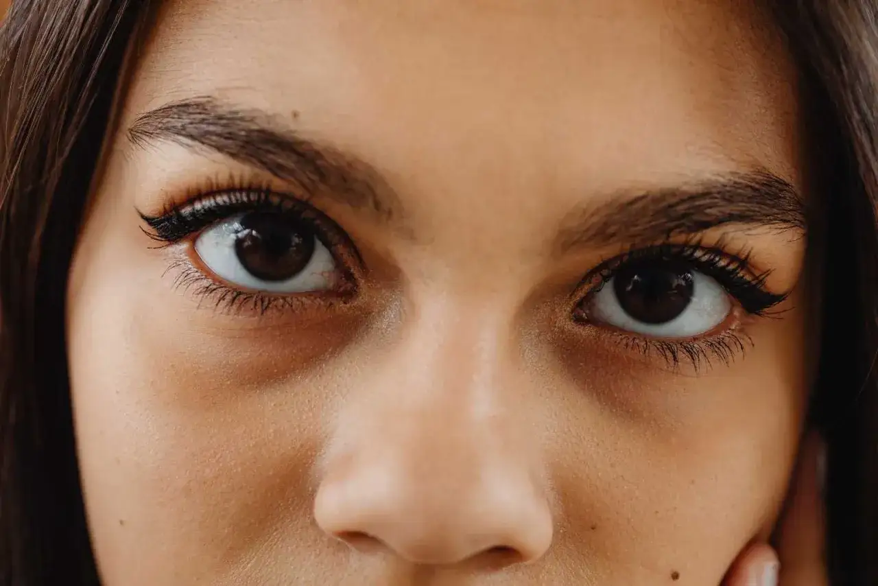 Ojos con ojeras marcadas. Consejos para cómo quitar las ojeras y lucir una mirada más fresca y descansada.