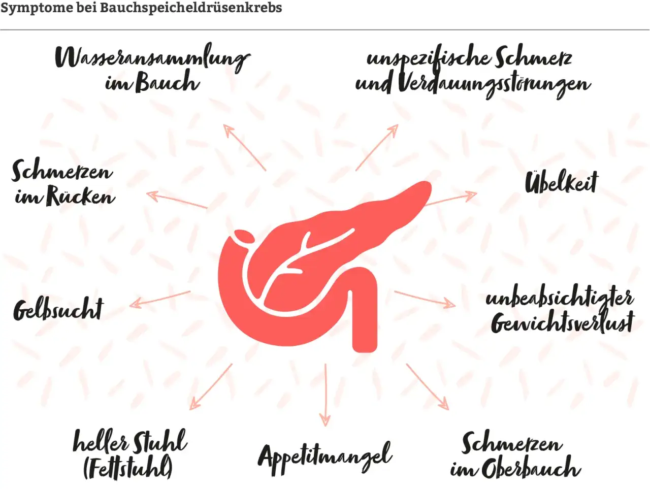 Grafik zeigt Bauchspeicheldrüse mit Pfeilen zu Symptomen wie Gelbsucht, Schmerzen im Rücken/Oberbauch, Gewichtsverlust. Frühzeitige Erkennung von Pankreaskarzinom Symptomen ist wichtig.