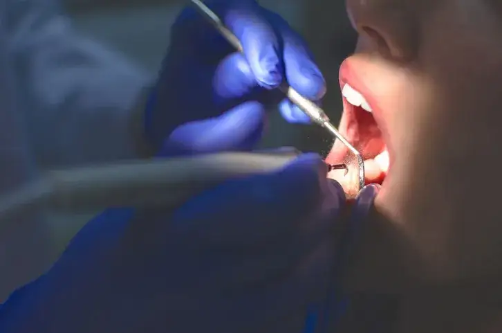 dentysta wykonujący stripping zębów