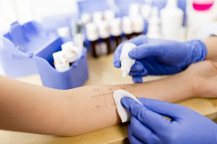 testy skórne alergia u dzieci