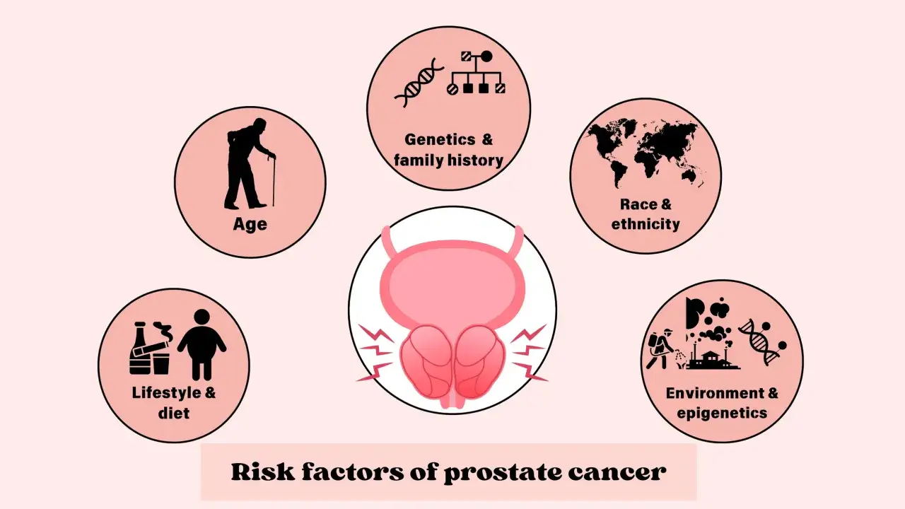 Factores de riesgo de cáncer de próstata: edad, estilo de vida, raza, ambiente y genética. El cáncer de próstata es hereditario.