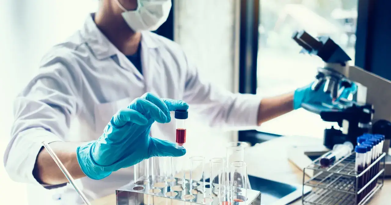Laborant w rękawiczkach trzyma probówkę z krwią. W tle mikroskop i inne naczynia laboratoryjne. To może być badanie CA 125.