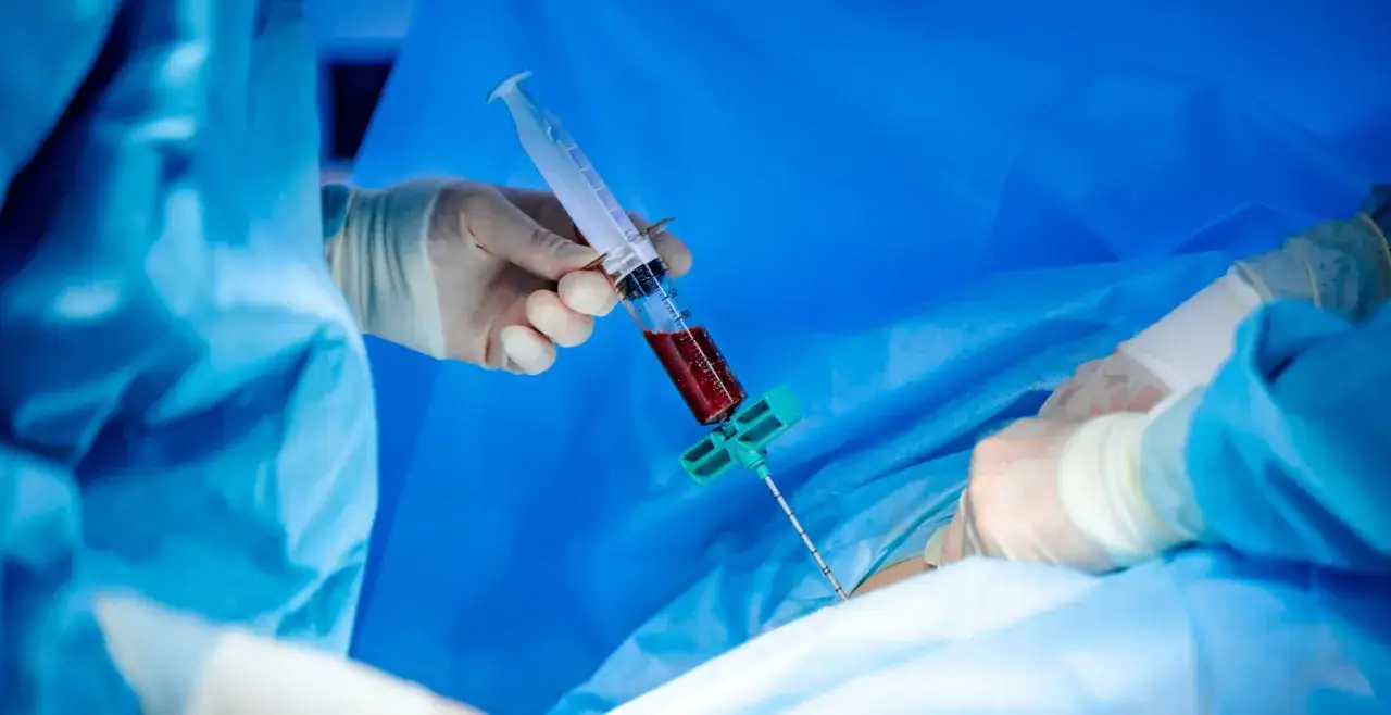 Pobieranie szpiku kostnego do diagnostyki zespołu mielodysplastycznego.