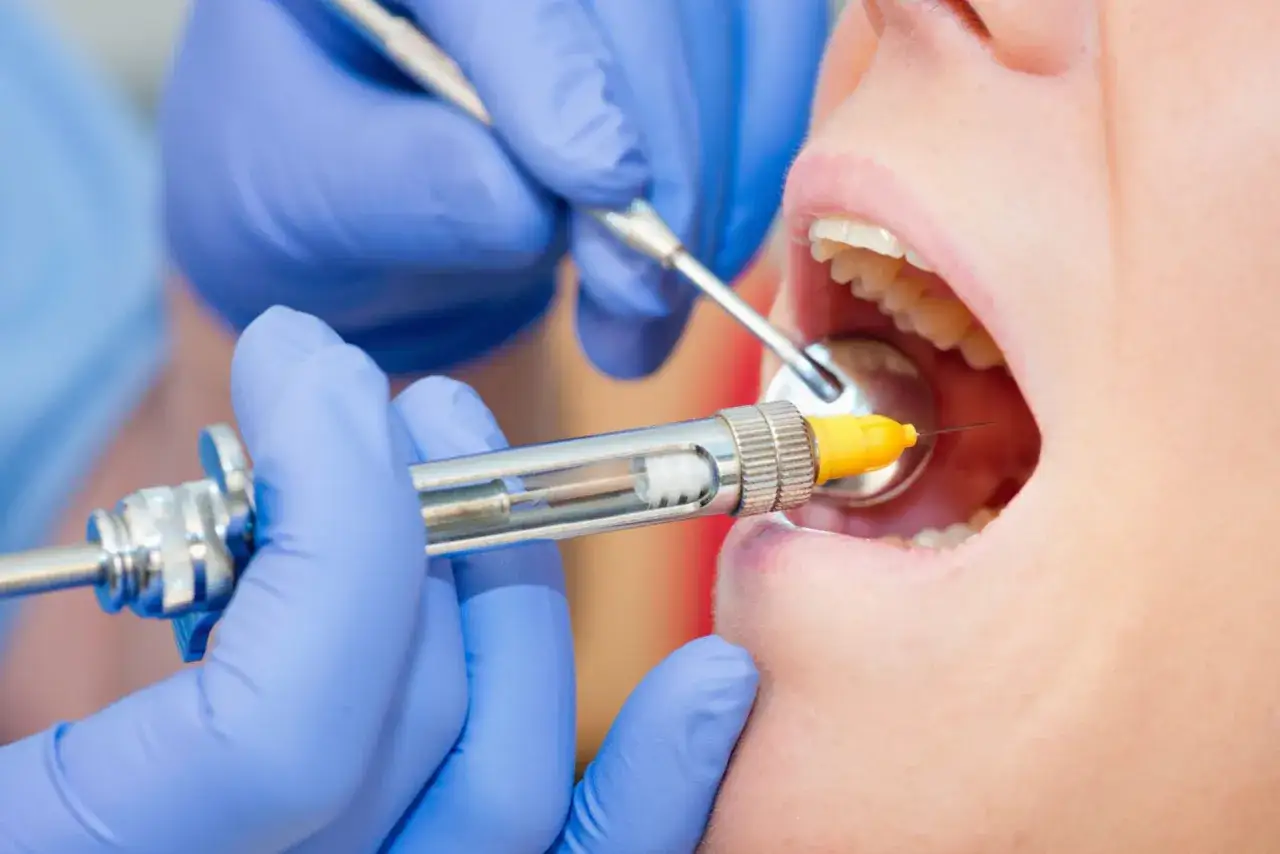 Dentysta wykonuje znieczulenie nasiękowe, podając środek znieczulający do jamy ustnej pacjenta.