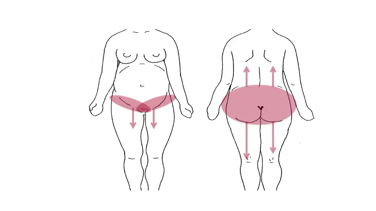 Schéma montrant les zones de douleur ligamentaire pendant la grossesse, au niveau du bassin et du bas du dos.