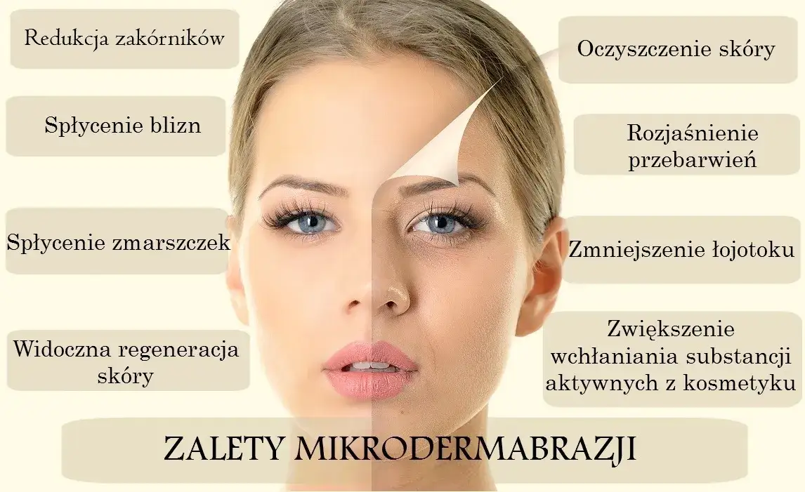 cennik mikrodermabrazji twarzy