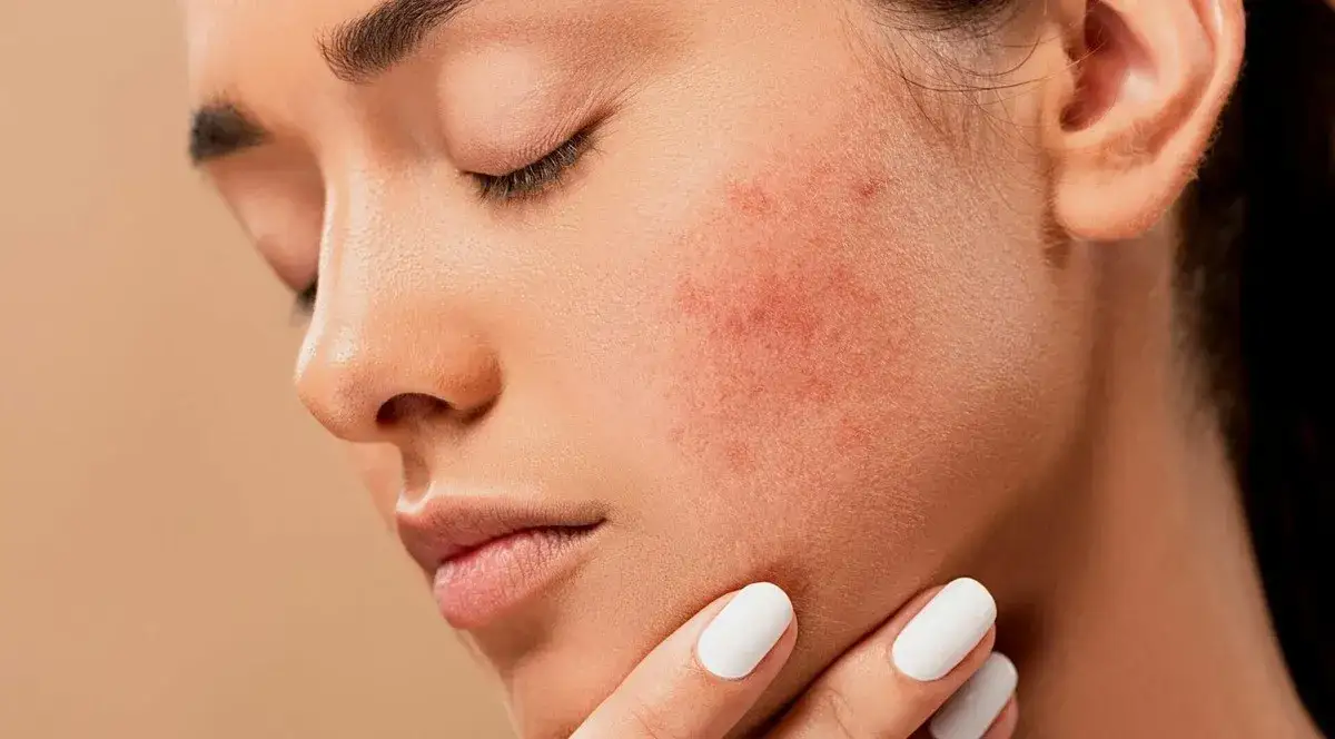 Dermatolog kosmetolog endokrynolog trądzik