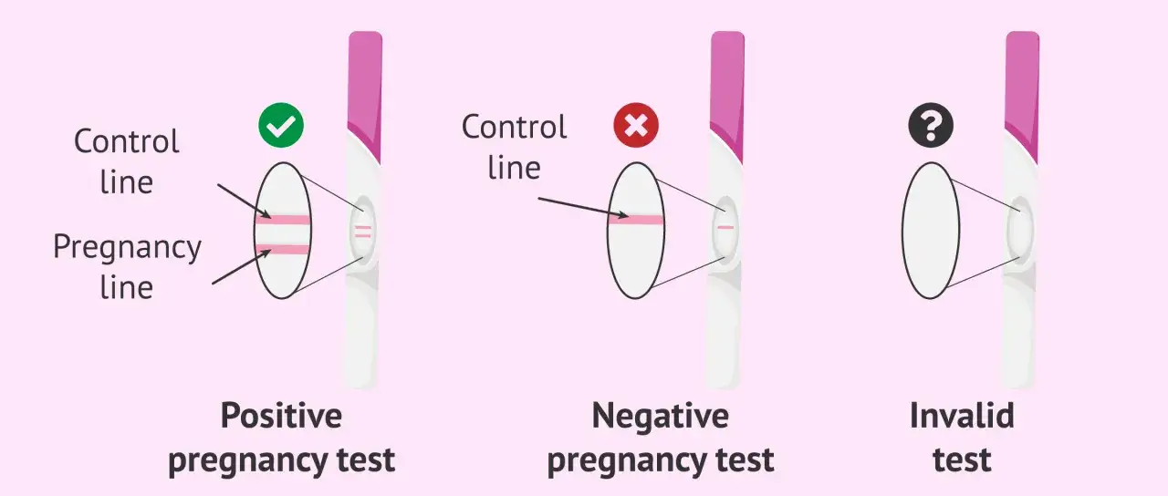 Trois tests de grossesse : positif (deux lignes), négatif (une ligne) et un test de grossesse qui ne fonctionne pas (pas de ligne visible).