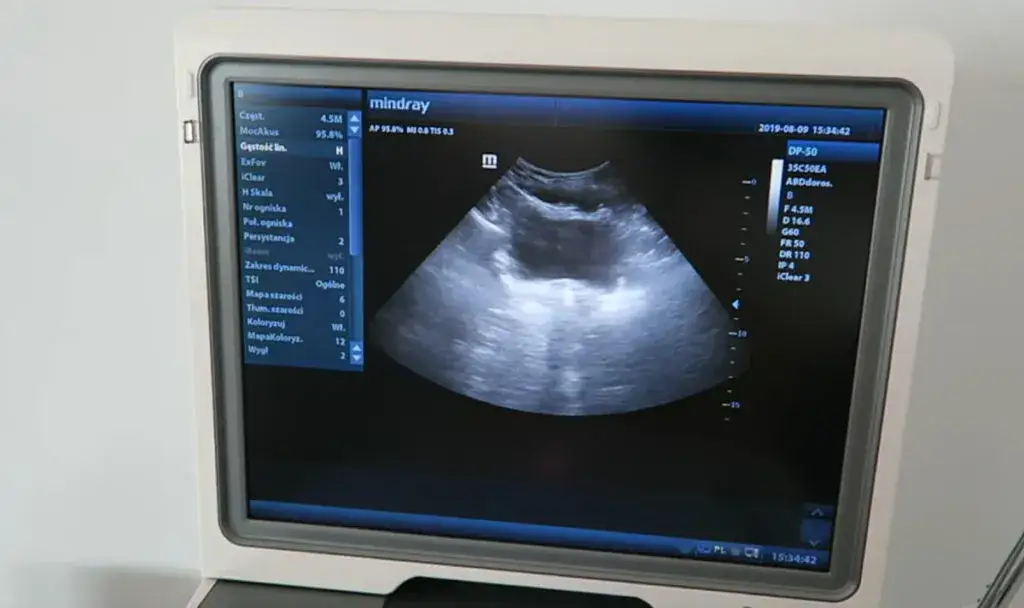 USG dna miednicy