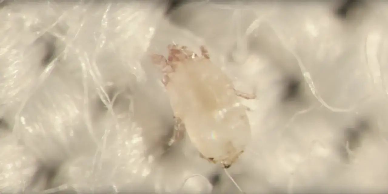 Microscopic view of a dust mite, a common inhabitant of mattress beds, on white fabric fibers.