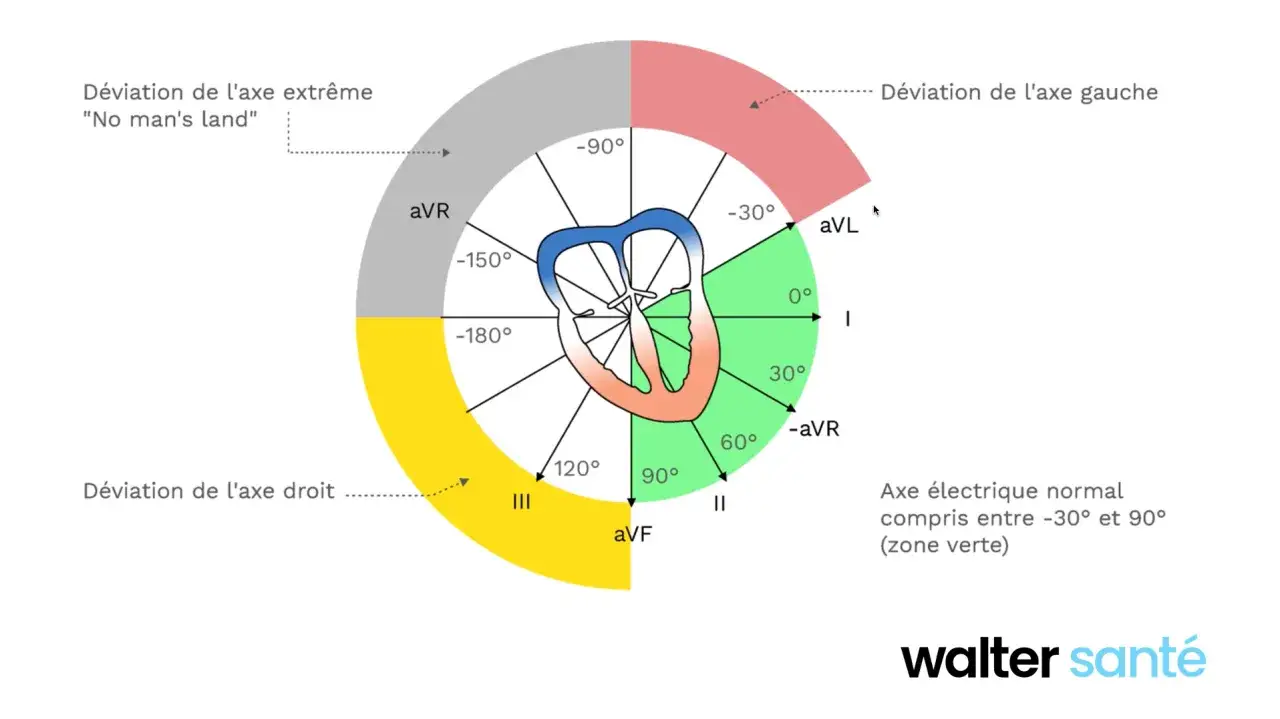 Sch&eacute;ma pour faire un ECG : le c&oelig;ur au centre d'un cercle gradu&eacute; montrant les axes &eacute;lectriques normaux et d&eacute;vi&eacute;s.