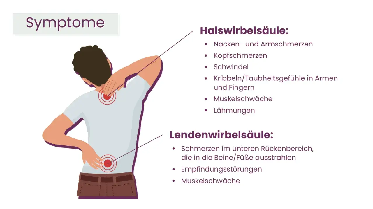 Illustration zeigt einen Mann mit Schmerzen im Nacken und unteren Rücken. Bandscheibenvorfall Schmerzen gehen nicht weg, was zu Nacken-, Kopf- und Rückenschmerzen führt.