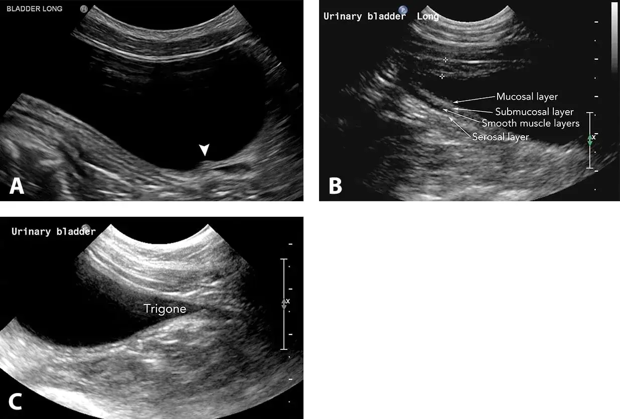 Ecografía de vejiga canina. Imagen A muestra un cálculo (triángulo blanco). Imagen B detalla capas de la pared vesical. Imagen C señala el trígono. Ayuda a diagnosticar incontinencia urinaria en perros.