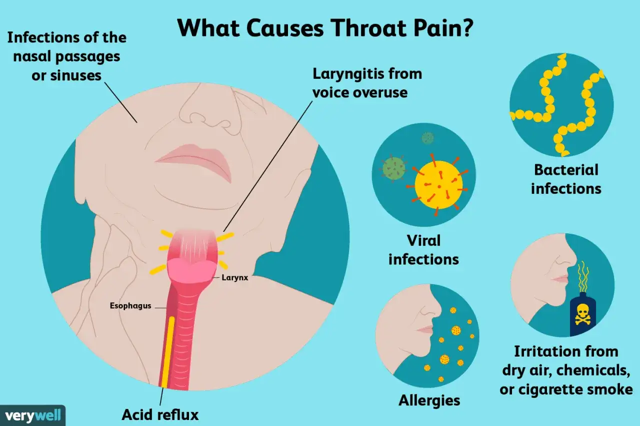 Causes de mal de gorge : infections, laryngite, reflux acide, allergies, irritations. Difficile à avaler.