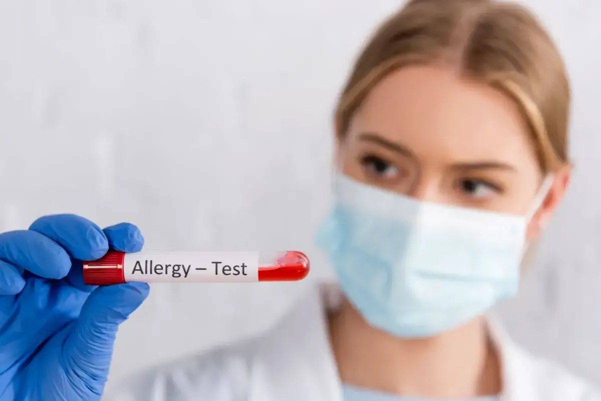 Rękawiczka w niebieskiej rękawiczce trzyma probówkę z krwią do testów alergicznych.
