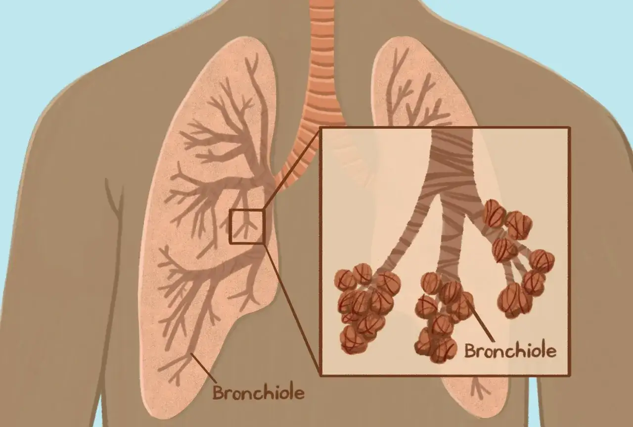 Lunge mit verzweigten Bronchien und Bronchiolen, die zu kleinen Bl&auml;schen f&uuml;hren.