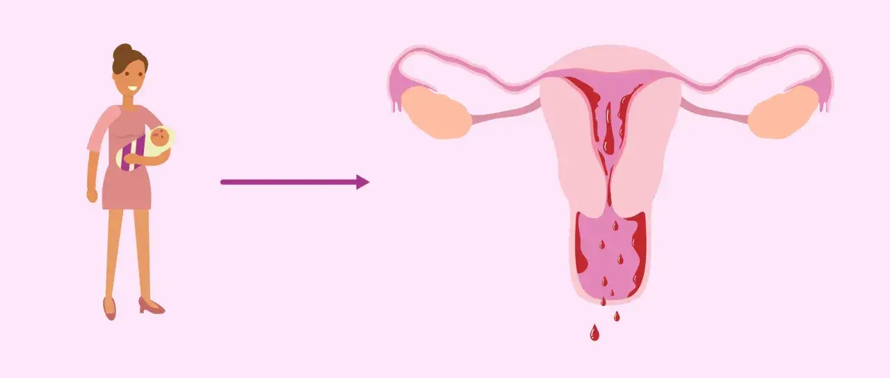 Ilustraci&oacute;n de una madre con su beb&eacute;, seguida de una flecha que apunta a un &uacute;tero con sangrado. Representa cuando viene la regla despu&eacute;s del parto.