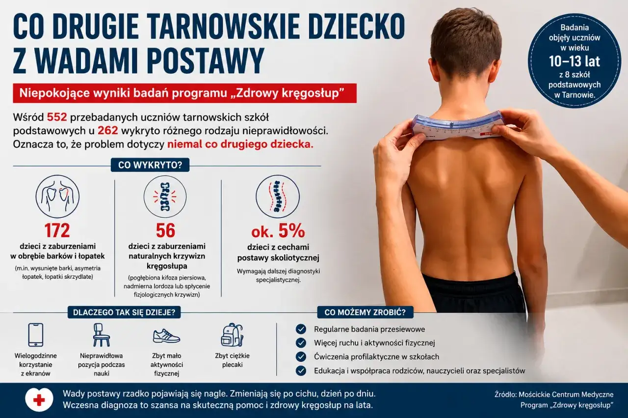 Niemal co drugie dziecko w Tarnowie ma garb na plecach lub inne wady postawy. Badania wykazały niepokojące wyniki.
