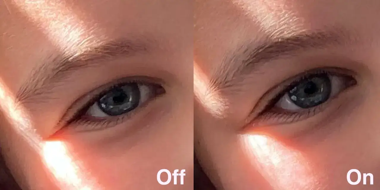 Ojo con luz solar. La imagen de la izquierda muestra el efecto 